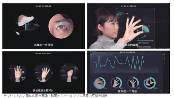 テサントAI